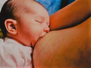 Lee más sobre el artículo Ingurgitación patológica durante la lactancia materna